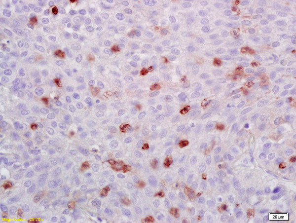 ATF1 Antibody in Immunohistochemistry (Paraffin) (IHC (P))