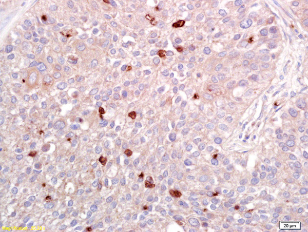 ATF2 Antibody in Immunohistochemistry (Paraffin) (IHC (P))