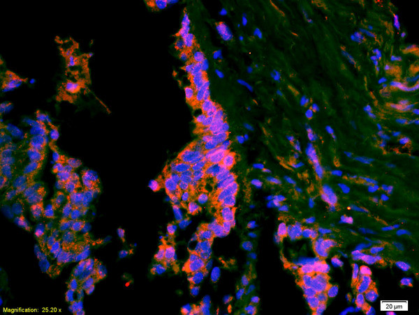 ATF3 Antibody in Immunohistochemistry (Paraffin) (IHC (P))