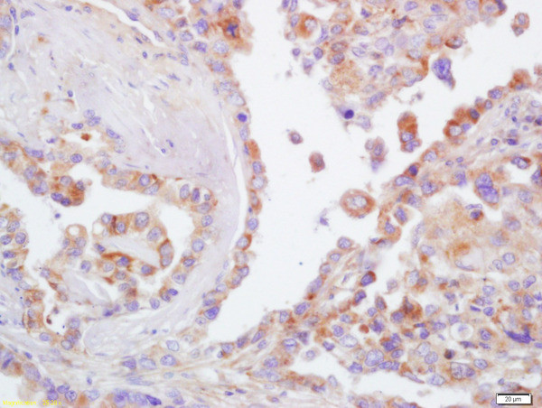 CD44 Antibody in Immunohistochemistry (Paraffin) (IHC (P))
