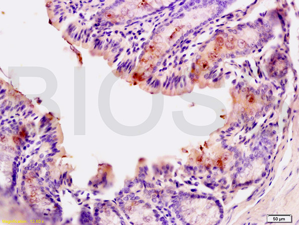 CD10 Antibody in Immunohistochemistry (Paraffin) (IHC (P))