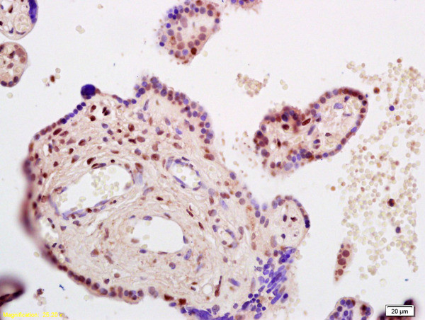 CDKN1C Antibody in Immunohistochemistry (Paraffin) (IHC (P))