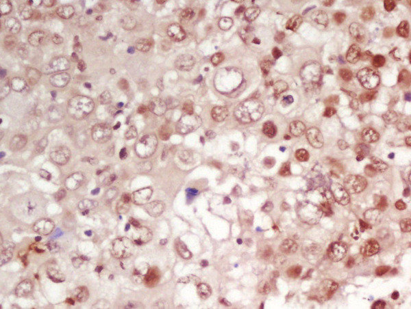 CDK1 Antibody in Immunohistochemistry (Paraffin) (IHC (P))