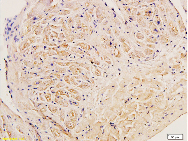 Collagen 3 Antibody in Immunohistochemistry (Paraffin) (IHC (P))