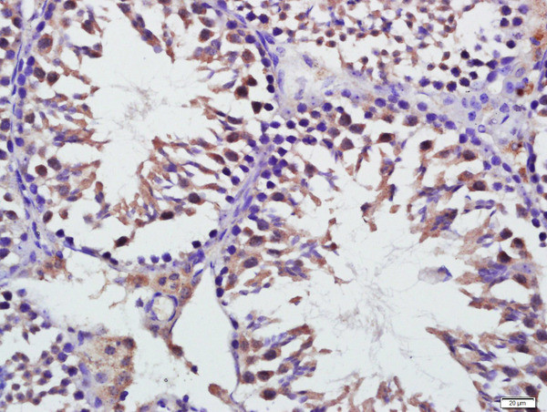 Mfn1 Antibody in Immunohistochemistry (Paraffin) (IHC (P))