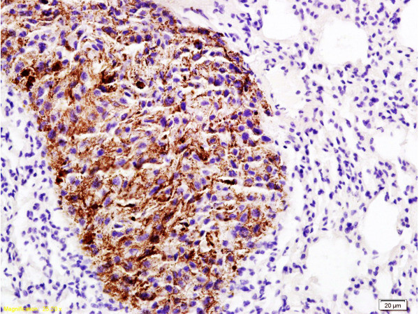 EMP1 Antibody in Immunohistochemistry (Paraffin) (IHC (P))