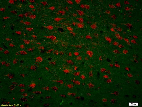 CDK5 Antibody in Immunohistochemistry (Paraffin) (IHC (P))