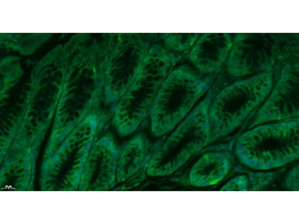 CD62p Antibody in Immunohistochemistry (Paraffin) (IHC (P))