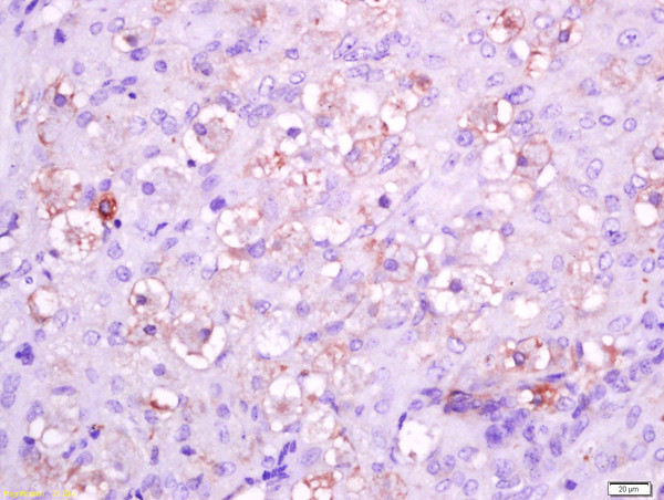 Integrin alpha 5 Antibody in Immunohistochemistry (Paraffin) (IHC (P))