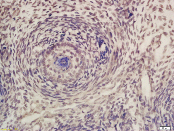 CDK7 Antibody in Immunohistochemistry (Paraffin) (IHC (P))