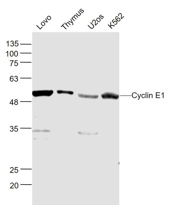 Cyclin E Antibody in Western Blot (WB)