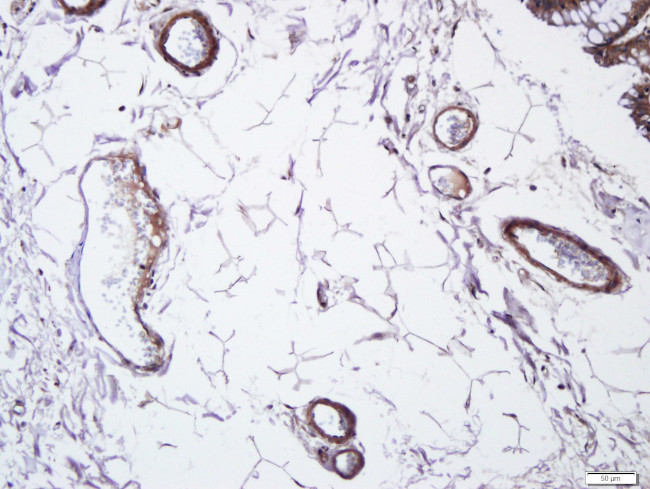CD105 Antibody in Immunohistochemistry (Paraffin) (IHC (P))
