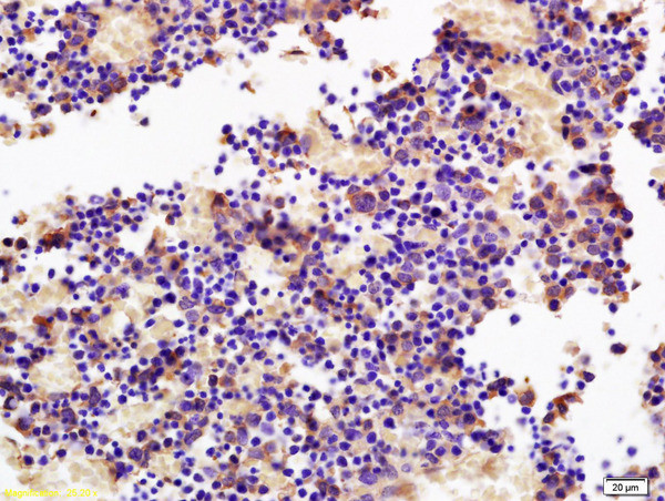 SOCS3 Antibody in Immunohistochemistry (Paraffin) (IHC (P))