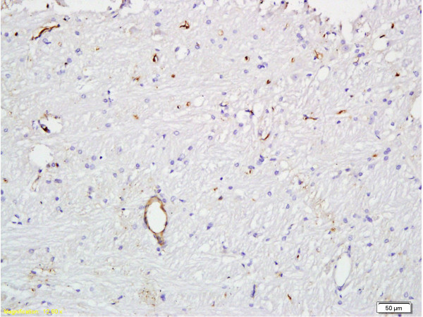 VWF Antibody in Immunohistochemistry (Paraffin) (IHC (P))