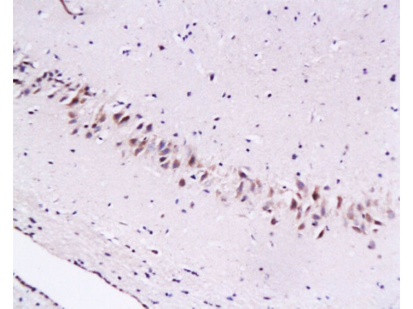 Cytoglobin Antibody in Immunohistochemistry (Paraffin) (IHC (P))
