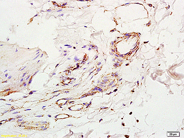 IL-2 Antibody in Immunohistochemistry (Paraffin) (IHC (P))