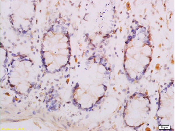 Adiponectin Receptor 1 Antibody in Immunohistochemistry (Paraffin) (IHC (P))