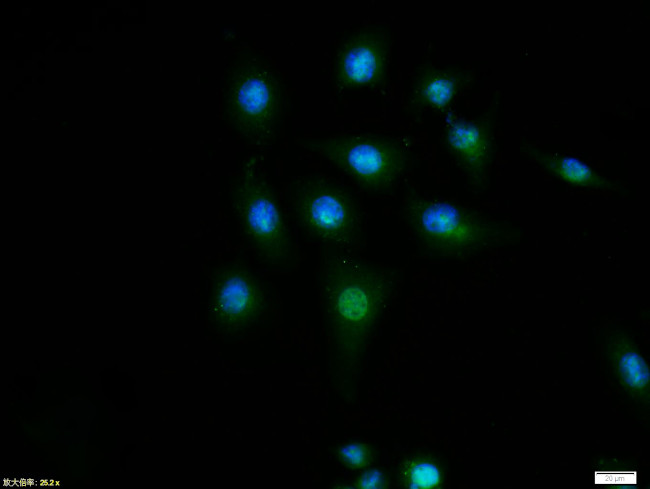 Cyclin D1 Antibody in Immunocytochemistry (ICC/IF)
