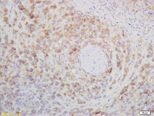 CD272 Antibody in Immunohistochemistry (Paraffin) (IHC (P))
