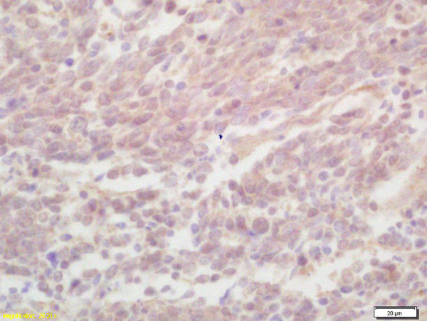 ZNF268 Antibody in Immunohistochemistry (Paraffin) (IHC (P))
