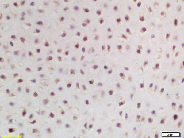 ZNF268 Antibody in Immunohistochemistry (Paraffin) (IHC (P))