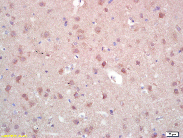 ZNF300 Antibody in Immunohistochemistry (Paraffin) (IHC (P))