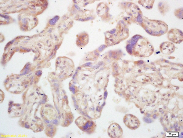 Estrogen Sulfotransferase Antibody in Immunohistochemistry (Paraffin) (IHC (P))