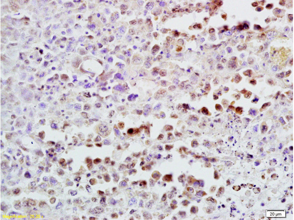 CDK4 Antibody in Immunohistochemistry (Paraffin) (IHC (P))