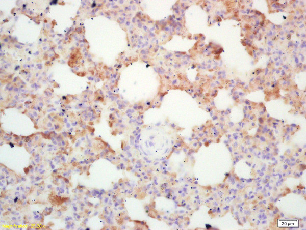 Integrin alpha 4/CD49d Antibody in Immunohistochemistry (Paraffin) (IHC (P))