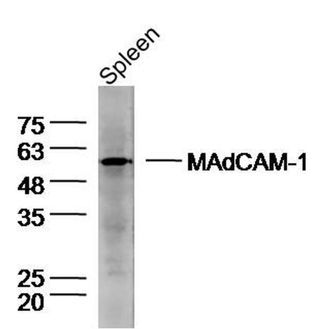 MAdCAM-1 Antibody in Western Blot (WB)