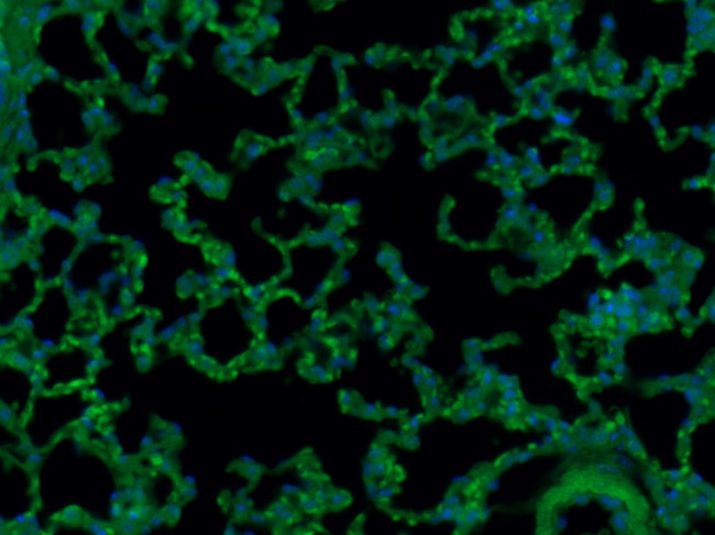 CD8 Antibody in Immunohistochemistry (Paraffin) (IHC (P))