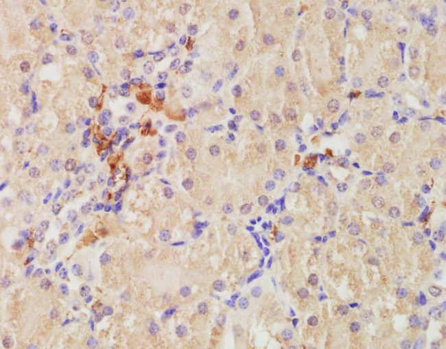 CD68 Antibody in Immunohistochemistry (Paraffin) (IHC (P))
