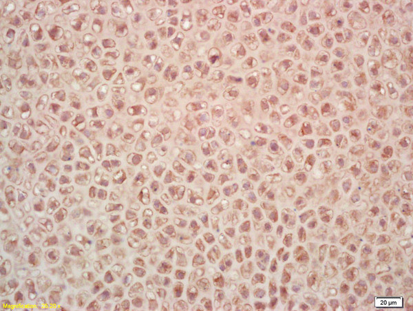 PAK7 Antibody in Immunohistochemistry (Paraffin) (IHC (P))