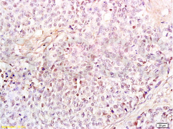 HMGB1 Antibody in Immunohistochemistry (Paraffin) (IHC (P))