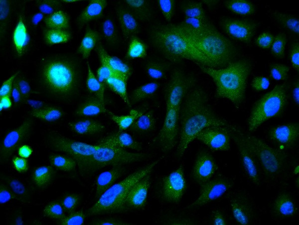 c-Jun Antibody in Immunocytochemistry (ICC/IF)
