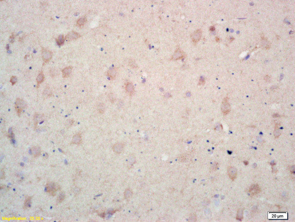 MCK10 Antibody in Immunohistochemistry (Paraffin) (IHC (P))