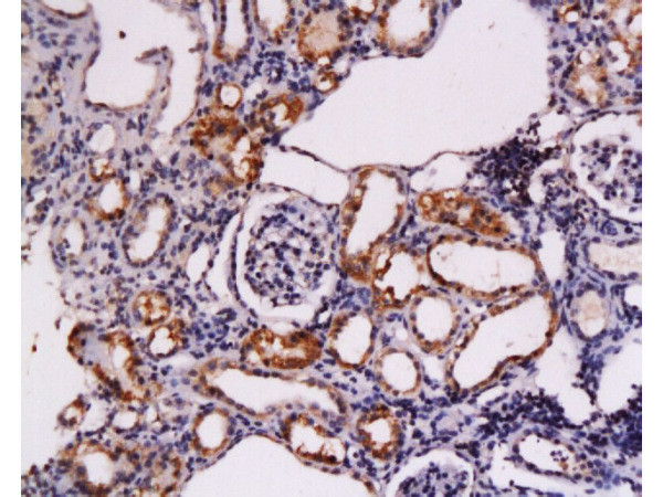 c-Kit Antibody in Immunohistochemistry (Paraffin) (IHC (P))