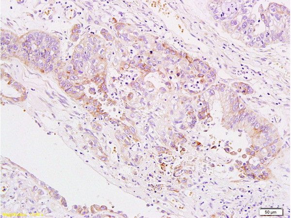B7H4 Antibody in Immunohistochemistry (Paraffin) (IHC (P))