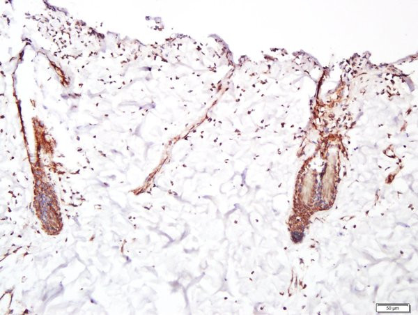 FGFR2 Antibody in Immunohistochemistry (Paraffin) (IHC (P))
