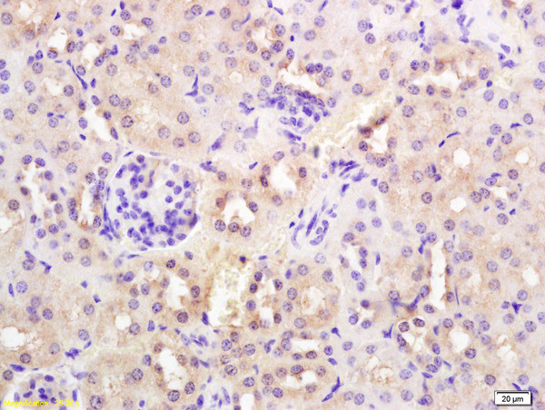 SYVN1 Antibody in Immunohistochemistry (Paraffin) (IHC (P))