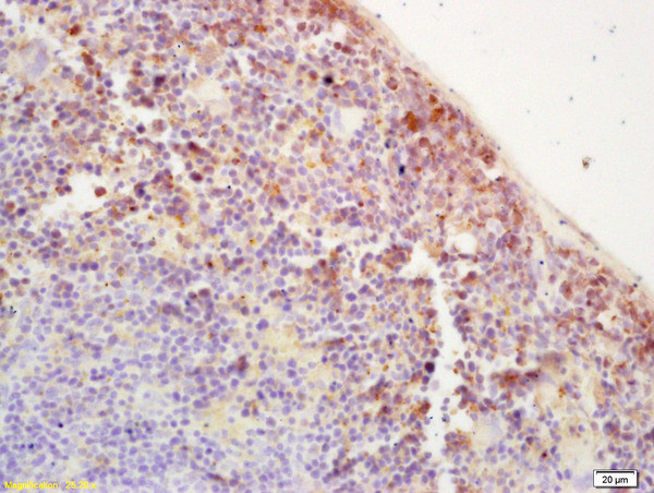 IGF1R Antibody in Immunohistochemistry (Paraffin) (IHC (P))