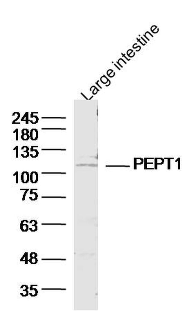 PEPT1 Antibody in Western Blot (WB)