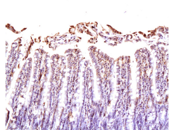 Neuropilin 1 Antibody in Immunohistochemistry (Paraffin) (IHC (P))