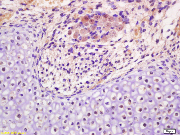 NSBP1 Antibody in Immunohistochemistry (Paraffin) (IHC (P))