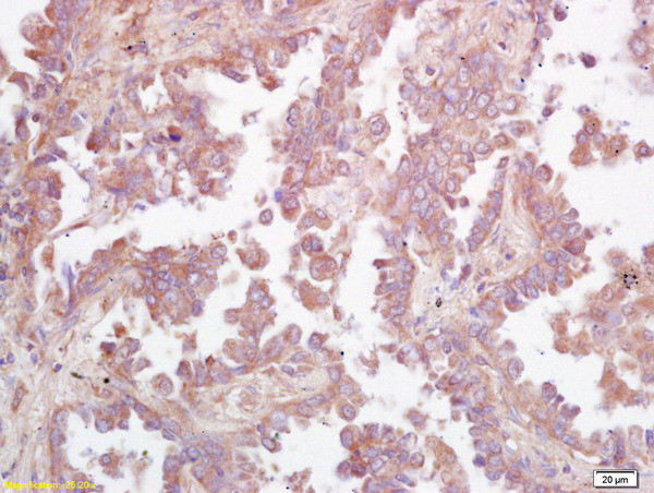 Ceramide glucosyltransferase Antibody in Immunohistochemistry (Paraffin) (IHC (P))
