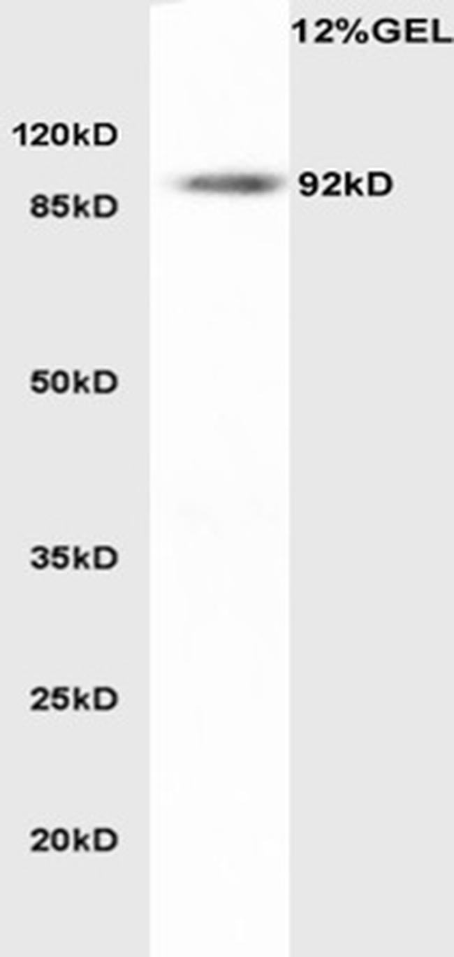 LDL receptor Antibody in Western Blot (WB)