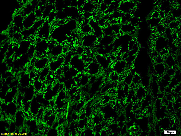 Neurofilament H Antibody in Immunohistochemistry (Paraffin) (IHC (P))
