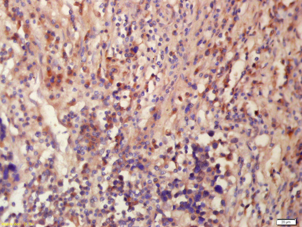 Tubulin-Beta 3 Antibody in Immunohistochemistry (Paraffin) (IHC (P))