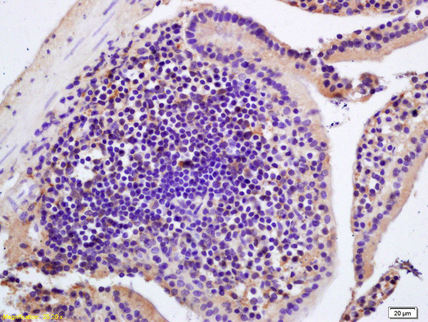 CIDEB Antibody in Immunohistochemistry (Paraffin) (IHC (P))