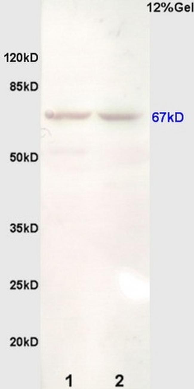 Estrogen Receptor alpha Antibody in Western Blot (WB)